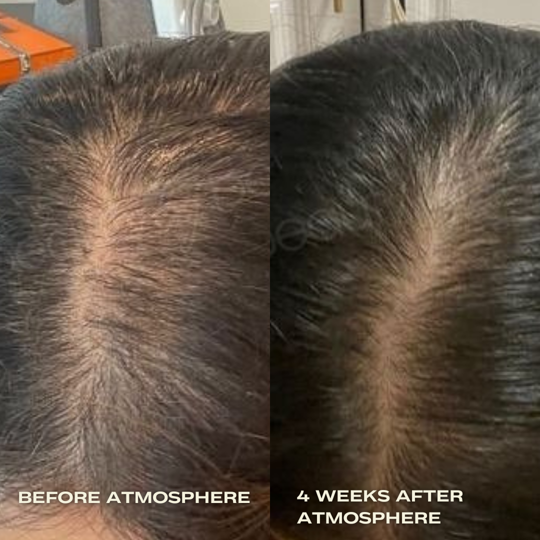 Luna Nectar - Atmosphere Multi-Peptide Hair Density & Scalp Serum