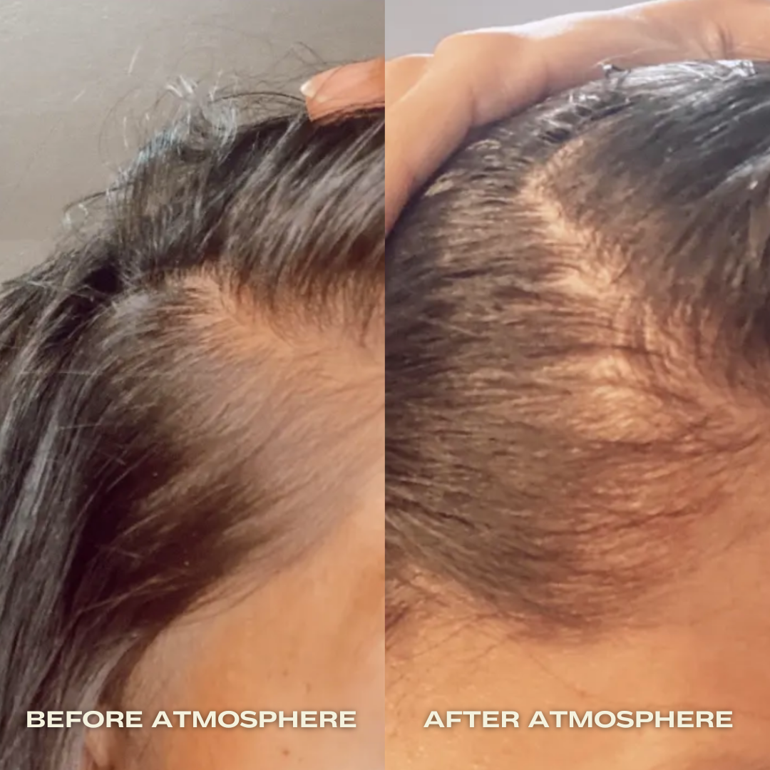 Luna Nectar - Atmosphere Multi-Peptide Hair Density & Scalp Serum